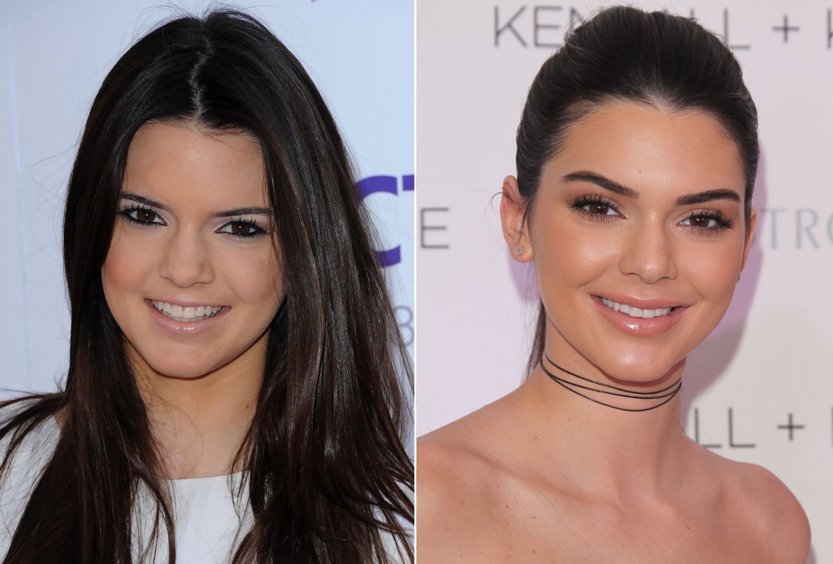 20 Celebrities Who Have Transformed Since 2010